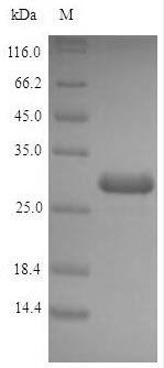(Tris-Glycine gel) Discontinuous SDS-PAGE (reduced) with 5% enrichment gel and 15% separation gel. (Tris-Glycine gel) Discontinuous SDS-PAGE (reduced) with 5% enrichment gel and 15% separation gel.