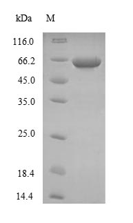 (Tris-Glycine gel) Discontinuous SDS-PAGE (reduced) with 5% enrichment gel and 15% separation gel. (Tris-Glycine gel) Discontinuous SDS-PAGE (reduced) with 5% enrichment gel and 15% separation gel.