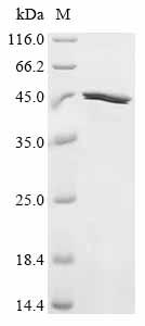 (Tris-Glycine gel) Discontinuous SDS-PAGE (reduced) with 5% enrichment gel and 15% separation gel.