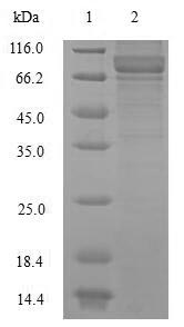 CSB-EP015688HU SDS-PAGE