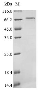 (Tris-Glycine gel) Discontinuous SDS-PAGE (reduced) with 5% enrichment gel and 15% separation gel. (Tris-Glycine gel) Discontinuous SDS-PAGE (reduced) with 5% enrichment gel and 15% separation gel.