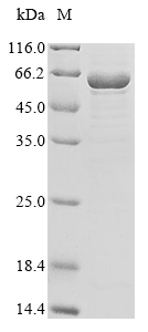 (Tris-Glycine gel) Discontinuous SDS-PAGE (reduced) with 5% enrichment gel and 15% separation gel. (Tris-Glycine gel) Discontinuous SDS-PAGE (reduced) with 5% enrichment gel and 15% separation gel.