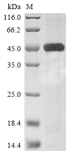 (Tris-Glycine gel) Discontinuous SDS-PAGE (reduced) with 5% enrichment gel and 15% separation gel.