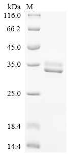 Recombinant Chicken Neurofibromin (NF1) , partial - image 1