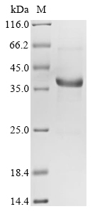 Recombinant Human Neurofibromin (NF1) , partial - image 1