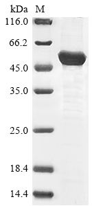 (Tris-Glycine gel) Discontinuous SDS-PAGE (reduced) with 5% enrichment gel and 15% separation gel. (Tris-Glycine gel) Discontinuous SDS-PAGE (reduced) with 5% enrichment gel and 15% separation gel.