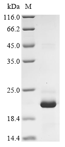 (Tris-Glycine gel) Discontinuous SDS-PAGE (reduced) with 5% enrichment gel and 15% separation gel. (Tris-Glycine gel) Discontinuous SDS-PAGE (reduced) with 5% enrichment gel and 15% separation gel.