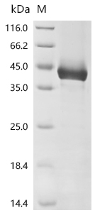 (Tris-Glycine gel) Discontinuous SDS-PAGE (reduced) with 5% enrichment gel and 15% separation gel.