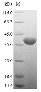 (Tris-Glycine gel) Discontinuous SDS-PAGE (reduced) with 5% enrichment gel and 15% separation gel.