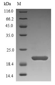 (Tris-Glycine gel) Discontinuous SDS-PAGE (reduced) with 5% enrichment gel and 15% separation gel. (Tris-Glycine gel) Discontinuous SDS-PAGE (reduced) with 5% enrichment gel and 15% separation gel.