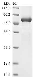 (Tris-Glycine gel) Discontinuous SDS-PAGE (reduced) with 5% enrichment gel and 15% separation gel. (Tris-Glycine gel) Discontinuous SDS-PAGE (reduced) with 5% enrichment gel and 15% separation gel.