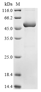 (Tris-Glycine gel) Discontinuous SDS-PAGE (reduced) with 5% enrichment gel and 15% separation gel. (Tris-Glycine gel) Discontinuous SDS-PAGE (reduced) with 5% enrichment gel and 15% separation gel.