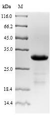 (Tris-Glycine gel) Discontinuous SDS-PAGE (reduced) with 5% enrichment gel and 15% separation gel. (Tris-Glycine gel) Discontinuous SDS-PAGE (reduced) with 5% enrichment gel and 15% separation gel.