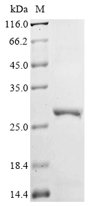(Tris-Glycine gel) Discontinuous SDS-PAGE (reduced) with 5% enrichment gel and 15% separation gel. (Tris-Glycine gel) Discontinuous SDS-PAGE (reduced) with 5% enrichment gel and 15% separation gel.