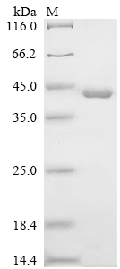 Recombinant Human Glucocorticoid receptor (NR3C1) , partial - image 1