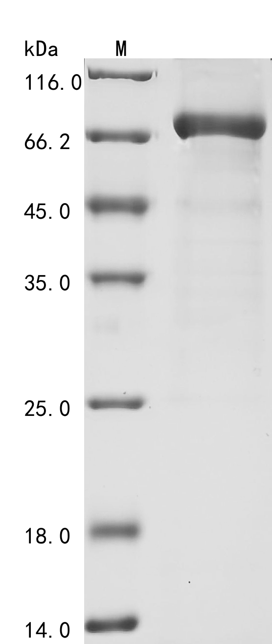 (Tris-Glycine gel) Discontinuous SDS-PAGE (reduced) with 5% enrichment gel and 15% separation gel. (Tris-Glycine gel) Discontinuous SDS-PAGE (reduced) with 5% enrichment gel and 15% separation gel.