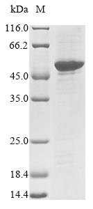 (Tris-Glycine gel) Discontinuous SDS-PAGE (reduced) with 5% enrichment gel and 15% separation gel. (Tris-Glycine gel) Discontinuous SDS-PAGE (reduced) with 5% enrichment gel and 15% separation gel.