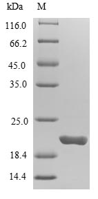 (Tris-Glycine gel) Discontinuous SDS-PAGE (reduced) with 5% enrichment gel and 15% separation gel. (Tris-Glycine gel) Discontinuous SDS-PAGE (reduced) with 5% enrichment gel and 15% separation gel.