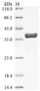 (Tris-Glycine gel) Discontinuous SDS-PAGE (reduced) with 5% enrichment gel and 15% separation gel.