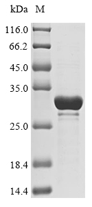 (Tris-Glycine gel) Discontinuous SDS-PAGE (reduced) with 5% enrichment gel and 15% separation gel. (Tris-Glycine gel) Discontinuous SDS-PAGE (reduced) with 5% enrichment gel and 15% separation gel.