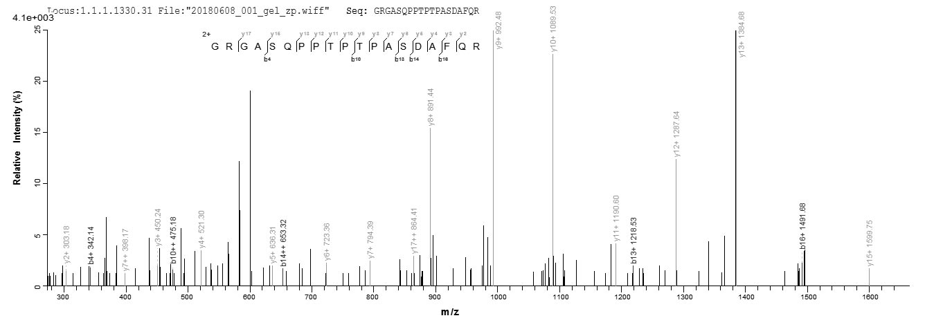 LC-MS Analysis 2- Recombinant protein Human OSM