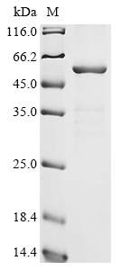 (Tris-Glycine gel) Discontinuous SDS-PAGE (reduced) with 5% enrichment gel and 15% separation gel. (Tris-Glycine gel) Discontinuous SDS-PAGE (reduced) with 5% enrichment gel and 15% separation gel.