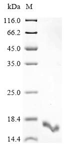 (Tris-Glycine gel) Discontinuous SDS-PAGE (reduced) with 5% enrichment gel and 15% separation gel. (Tris-Glycine gel) Discontinuous SDS-PAGE (reduced) with 5% enrichment gel and 15% separation gel.