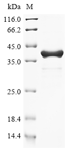 (Tris-Glycine gel) Discontinuous SDS-PAGE (reduced) with 5% enrichment gel and 15% separation gel. (Tris-Glycine gel) Discontinuous SDS-PAGE (reduced) with 5% enrichment gel and 15% separation gel.