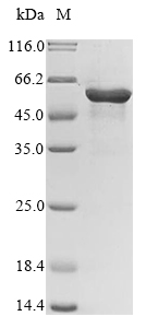 (Tris-Glycine gel) Discontinuous SDS-PAGE (reduced) with 5% enrichment gel and 15% separation gel. (Tris-Glycine gel) Discontinuous SDS-PAGE (reduced) with 5% enrichment gel and 15% separation gel.