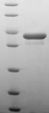 (Tris-Glycine gel) Discontinuous SDS-PAGE (reduced) with 5% enrichment gel and 15% separation gel. (Tris-Glycine gel) Discontinuous SDS-PAGE (reduced) with 5% enrichment gel and 15% separation gel.