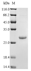 (Tris-Glycine gel) Discontinuous SDS-PAGE (reduced) with 5% enrichment gel and 15% separation gel. (Tris-Glycine gel) Discontinuous SDS-PAGE (reduced) with 5% enrichment gel and 15% separation gel.