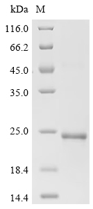 Recombinant Mouse Platelet-derived growth factor subunit B (Pdgfb) - image 1