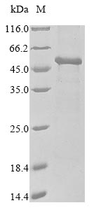 (Tris-Glycine gel) Discontinuous SDS-PAGE (reduced) with 5% enrichment gel and 15% separation gel. (Tris-Glycine gel) Discontinuous SDS-PAGE (reduced) with 5% enrichment gel and 15% separation gel.