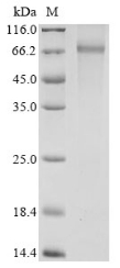 (Tris-Glycine gel) Discontinuous SDS-PAGE (reduced) with 5% enrichment gel and 15% separation gel. (Tris-Glycine gel) Discontinuous SDS-PAGE (reduced) with 5% enrichment gel and 15% separation gel.