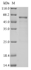 (Tris-Glycine gel) Discontinuous SDS-PAGE (reduced) with 5% enrichment gel and 15% separation gel. (Tris-Glycine gel) Discontinuous SDS-PAGE (reduced) with 5% enrichment gel and 15% separation gel.