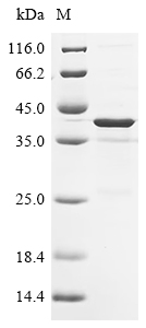Recombinant Mouse Platelet endothelial aggregation receptor 1 (Pear1) , partial - image 1