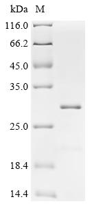 Recombinant Human Membrane-associated progesterone receptor component 2 (PGRMC2) , Partial - image 1