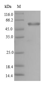 (Tris-Glycine gel) Discontinuous SDS-PAGE (reduced) with 5% enrichment gel and 15% separation gel. (Tris-Glycine gel) Discontinuous SDS-PAGE (reduced) with 5% enrichment gel and 15% separation gel.