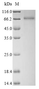 (Tris-Glycine gel) Discontinuous SDS-PAGE (reduced) with 5% enrichment gel and 15% separation gel. (Tris-Glycine gel) Discontinuous SDS-PAGE (reduced) with 5% enrichment gel and 15% separation gel.
