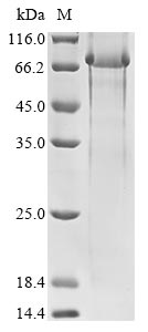 (Tris-Glycine gel) Discontinuous SDS-PAGE (reduced) with 5% enrichment gel and 15% separation gel. (Tris-Glycine gel) Discontinuous SDS-PAGE (reduced) with 5% enrichment gel and 15% separation gel.