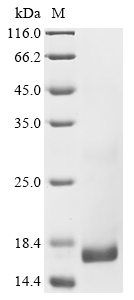 (Tris-Glycine gel) Discontinuous SDS-PAGE (reduced) with 5% enrichment gel and 15% separation gel. (Tris-Glycine gel) Discontinuous SDS-PAGE (reduced) with 5% enrichment gel and 15% separation gel.