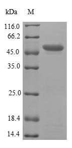 (Tris-Glycine gel) Discontinuous SDS-PAGE (reduced) with 5% enrichment gel and 15% separation gel. (Tris-Glycine gel) Discontinuous SDS-PAGE (reduced) with 5% enrichment gel and 15% separation gel.