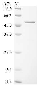 Recombinant Human Paraneoplastic antigen Ma2 (PNMA2) , partial - image 1