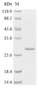 Recombinant Human Patatin-like phospholipase domain-containing protein 4 (PNPLA4) - image 1
