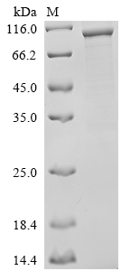 (Tris-Glycine gel) Discontinuous SDS-PAGE (reduced) with 5% enrichment gel and 15% separation gel. (Tris-Glycine gel) Discontinuous SDS-PAGE (reduced) with 5% enrichment gel and 15% separation gel.