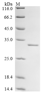 (Tris-Glycine gel) Discontinuous SDS-PAGE (reduced) with 5% enrichment gel and 15% separation gel. (Tris-Glycine gel) Discontinuous SDS-PAGE (reduced) with 5% enrichment gel and 15% separation gel.
