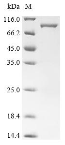 Recombinant Human Peroxisome prolifeRator-activated receptor gamma (PPARG) - image 1