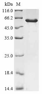 (Tris-Glycine gel) Discontinuous SDS-PAGE (reduced) with 5% enrichment gel and 15% separation gel. (Tris-Glycine gel) Discontinuous SDS-PAGE (reduced) with 5% enrichment gel and 15% separation gel.