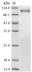 Recombinant Human Prolyl endopeptidase (PREP) , partial - image 1