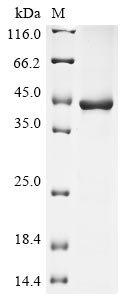 (Tris-Glycine gel) Discontinuous SDS-PAGE (reduced) with 5% enrichment gel and 15% separation gel. (Tris-Glycine gel) Discontinuous SDS-PAGE (reduced) with 5% enrichment gel and 15% separation gel.